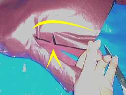 ��ʐς̏�����A�ꕔ���Ƀ{���h������